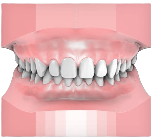 Up to 3mm