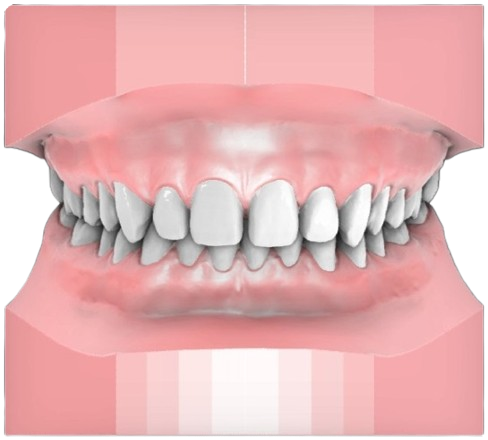 Up to 1mm